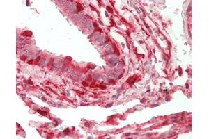 Immunohistochemistry (Paraffin-embedded Sections) (IHC (p)) image for anti-Alcohol Dehydrogenase 7 (Class IV), mu Or sigma Polypeptide (ADH7) antibody (FITC) (ABIN2614669)