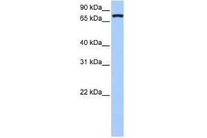 NLGN4X antibody used at 1 ug/ml to detect target protein. (Neuroligin 4 抗体  (Middle Region))