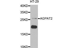 Western blot analysis of extracts of HT-29 cells, using AGPAT2 antibody. (AGPAT2 抗体)