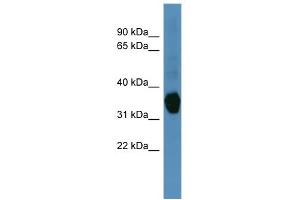 WB Suggested Anti-AKR1C1 Antibody Titration: 0. (AKR1C1 抗体  (N-Term))