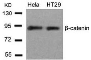 Image no. 3 for anti-Catenin (Cadherin-Associated Protein), beta 1, 88kDa (CTNNB1) (Ser33) antibody (ABIN197445) (CTNNB1 抗体  (Ser33))