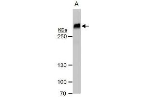 WB Image Filamin B antibody [N1], N-term detects Filamin B protein by western blot analysis. (FLNB 抗体  (N-Term))
