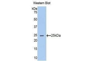 Western Blotting (WB) image for anti-Acetylcholinesterase (AChE) (AA 367-549) antibody (ABIN1857863) (Acetylcholinesterase 抗体  (AA 367-549))