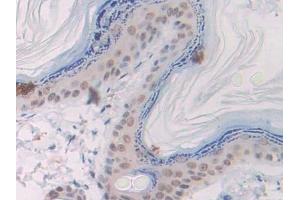 Detection of Slit1 in Rat Skin Tissue using Polyclonal Antibody to Slit Homolog 1 (Slit1)