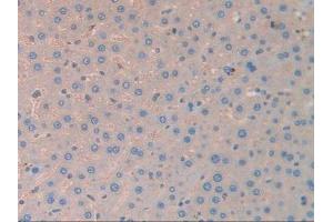 IHC-P analysis of Rat Liver Tissue, with DAB staining. (CA2 抗体)