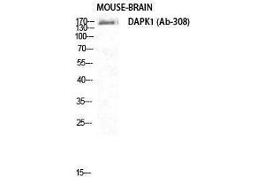 Western Blotting (WB) image for anti-Death-Associated Protein Kinase 1 (DAPK1) (Ser296) antibody (ABIN3174707) (DAP Kinase 1 抗体  (Ser296))