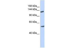 Western Blotting (WB) image for anti-Roundabout, Axon Guidance Receptor, Homolog 2 (ROBO2) antibody (ABIN2458930) (ROBO2 抗体)