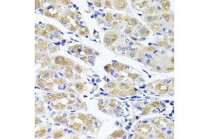 Immunohistochemistry of paraffin-embedded human gastric using SPATA4 antibody at dilution of 1:100 (x40 lens). (SPATA4 抗体)
