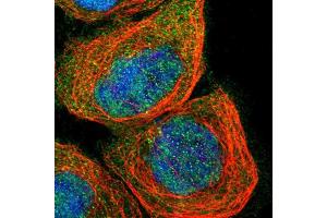 Immunofluorescent staining of human cell line A-431 shows localization to nucleoplasm, cytosol & centrosome. (SMAD4 抗体  (AA 118-240))