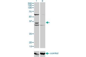 Western blot analysis of PAX9 over-expressed 293 cell line, cotransfected with PAX9 Validated Chimera RNAi (Lane 2) or non-transfected control (Lane 1). (PAX9 抗体  (AA 205-300))