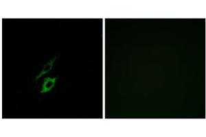 Immunofluorescence analysis of A549 cells, using FPR1 antibody. (FPR1 抗体  (Internal Region))