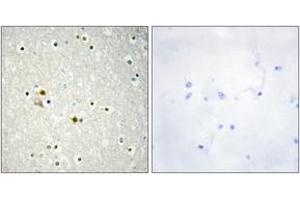 Immunohistochemistry analysis of paraffin-embedded human brain tissue, using DNL1 Antibody. (DNASE1 抗体  (AA 111-160))