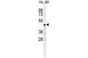 CHST2 Antibody (Center) western blot analysis in HL-60 cell line lysates (35µg/lane). (CHST2 抗体  (Middle Region))