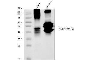 Western blot analysis of RAGE/AGER using anti-RAGE/AGER antibody (ABIN7603153).