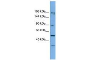 Image no. 1 for anti-TATA Box Binding Protein (TBP)-Associated Factor, RNA Polymerase I, C, 110kDa (TAF1C) (AA 701-750) antibody (ABIN6745644) (TAF1C 抗体  (AA 701-750))