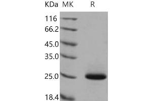 Lipocalin 2 (LCN2) (Active) protein (His tag)
