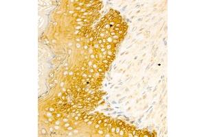Immunohistochemistry analysis of paraffin embedded rat stomcah using CK6 (ABIN7074423) at dilution of 1: 1000 (Keratin 6 抗体)