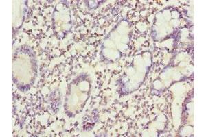 Immunohistochemistry of paraffin-embedded human small intestine tissue using ABIN7170406 at dilution of 1:100 (Sorting Nexin 7 抗体  (AA 85-330))
