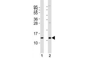 Western blot testing of CXCL12 antibody at 1:2000 dilution. (CXCL12 抗体)