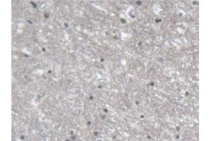 Immunohistochemistry (IHC) image for anti-ER Lipid Raft Associated 2 (ERLIN2) (AA 47-339) antibody (ABIN7441649)