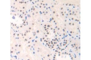 Used in DAB staining on fromalin fixed paraffin- embedded Kidney tissue (YAF2 抗体  (AA 1-177))