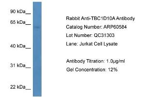 WB Suggested Anti-TBC1D10A  Antibody Titration: 0. (TBC1D10A 抗体  (C-Term))