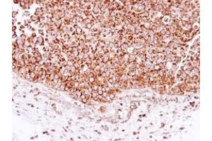 Image no. 1 for anti-2,4-Dienoyl CoA Reductase 1, Mitochondrial (DECR1) (AA 20-276) antibody (ABIN1497807) (DECR1 抗体  (AA 20-276))