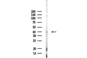 anti-Cyclin D-Type Binding-Protein 1 (CCNDBP1) antibody