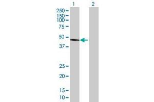 Western Blot analysis of ALLC expression in transfected 293T cell line by ALLC MaxPab polyclonal antibody. (Allantoicase 抗体  (AA 1-409))