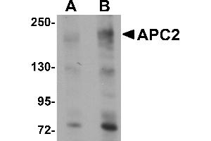 Western Blotting (WB) image for anti-APC Regulator of WNT Signaling Pathway 2 (APC2) (Middle Region) antibody (ABIN1030861) (APC2 抗体  (Middle Region))