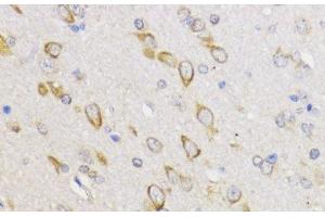Immunohistochemistry of paraffin-embedded Rat brain using Bcl-2 Polyclonal Antibody at dilution of 1:100 (40x lens). (Bcl-2 抗体)