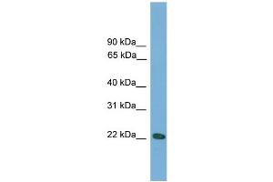 WB Suggested Anti-Rgs1 Antibody Titration:  0. (RGS1 抗体  (N-Term))