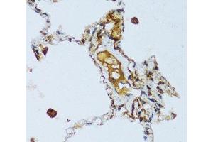 Immunohistochemistry of paraffin-embedded Human lung using C1QC Polyclonal Antibody at dilution of 1:100 (40x lens). (C1QC 抗体)