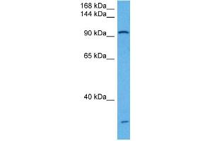 Host:  Rabbit  Target Name:  UBE3A  Sample Tissue:  Mouse Kidney  Antibody Dilution:  1ug/ml (ube3a 抗体  (Middle Region))