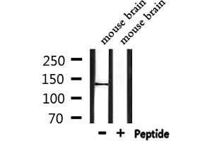 Western blot analysis of extracts from mouse brain, using TRPS1 Antibody. (TRPS1 抗体  (N-Term))