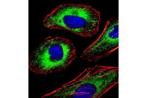 Immunofluorescent analysis of 4 % paraformaldehyde-fixed, 0. (FOXO4 抗体  (AA 206-240))
