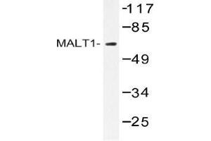 Western blot (WB) analysis of MALT1 antibody in extracts from HUVEC cells. (MALT1 抗体)