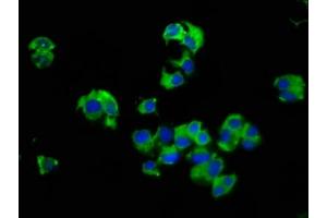 Immunofluorescence staining of MCF-7 cells with ABIN7175101 at 1:66, counter-stained with DAPI. (SLC14A1 抗体  (AA 1-51))