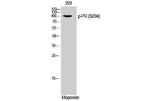 Western Blotting (WB) image for anti-PR (pSer294) antibody (ABIN3182419) (PR (pSer294) 抗体)
