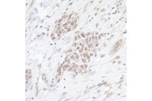 Immunohistochemistry (IHC) image for anti-SUMO1 Activating Enzyme Subunit 1 (SAE1) (AA 296-346) antibody (ABIN7453521)
