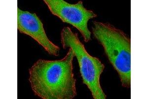 Fluorescent confocal image of HeLa cells stained with Tuberin antibody. (Tuberin 抗体  (AA 1776-1805))
