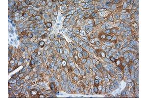 Immunohistochemistry (IHC) image for anti-Transforming, Acidic Coiled-Coil Containing Protein 3 (TACC3) antibody (ABIN1498098) (TACC3 抗体)