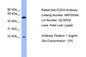 WB Suggested Anti-COCH  Antibody Titration: 0. (COCH 抗体  (C-Term))