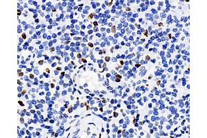 Immunohistochemistry analysis of paraffin-embedded human tonsil using ERK 2 Polyclonal Antibody at dilution of 1:100. (ERK2 抗体)