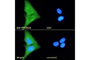 Immunofluorescence (IF) image for anti-Myosin Phosphatase, Target Subunit 1 (PPP1R12A) (C-Term) antibody (ABIN6391349)