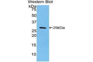 Western Blotting (WB) image for anti-Inhibitory Subunit of NF-KappaB zeta (AA 422-651) antibody (ABIN1859325) (Inhibitory Subunit of NF-KappaB zeta (AA 422-651) 抗体)