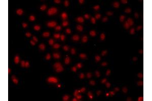 Immunofluorescence analysis of A549 cell using HNRNPA1 antibody. (HNRNPA1 抗体)