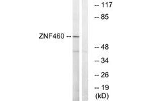 Western Blotting (WB) image for anti-Zinc Finger Protein 460 (ZNF460) (AA 461-510) antibody (ABIN2890699) (ZNF460 抗体  (AA 461-510))