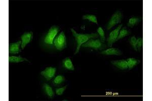 Immunofluorescence of monoclonal antibody to ADRM1 on HeLa cell. (ADRM1 抗体  (AA 18-407))
