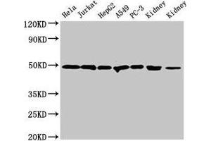 Western Blot Positive WB detected in: Hela whole cell lysate, Jurkat whole cell lysate, HepG2 whole cell lysate, A549 whole cell lysate, PC-3 whole cell lysate, Rat kidney tissue, Mouse kidney tissue All lanes: CALR antibody at 2 μg/mL Secondary Goat polyclonal to rabbit IgG at 1/50000 dilution Predicted band size: 49 kDa Observed band size: 49 kDa (Calreticulin 抗体  (AA 18-415))